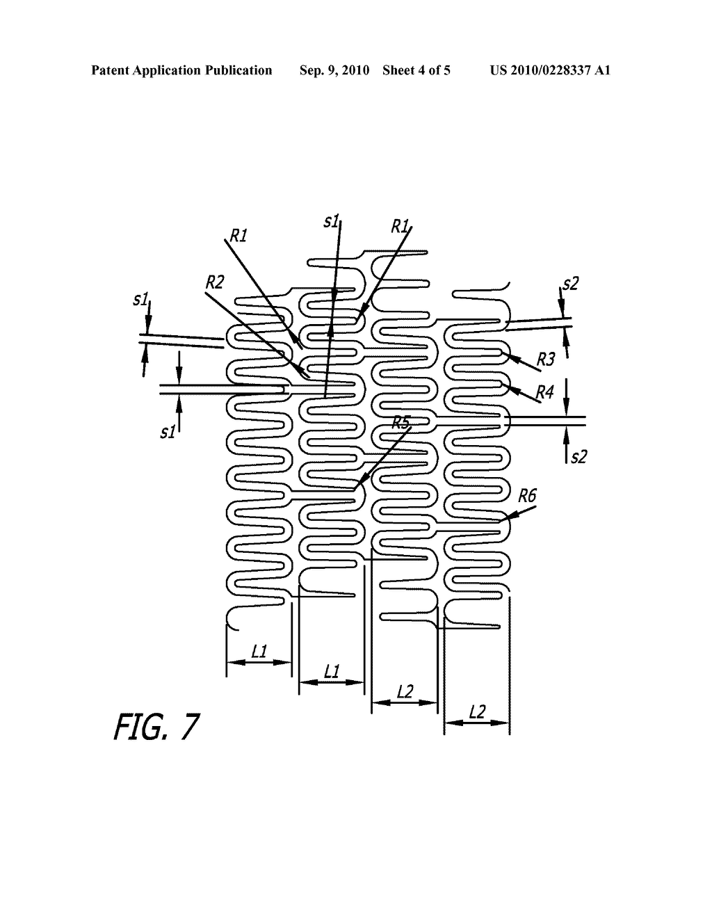 MIRROR IMAGE STENT AND METHOD OF USE - diagram, schematic, and image 05