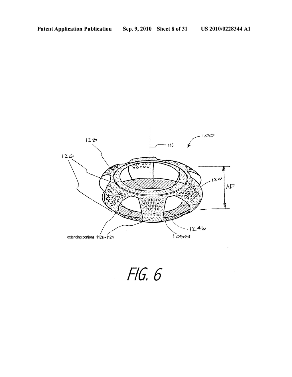 Accommodating Intraocular Lens - diagram, schematic, and image 09