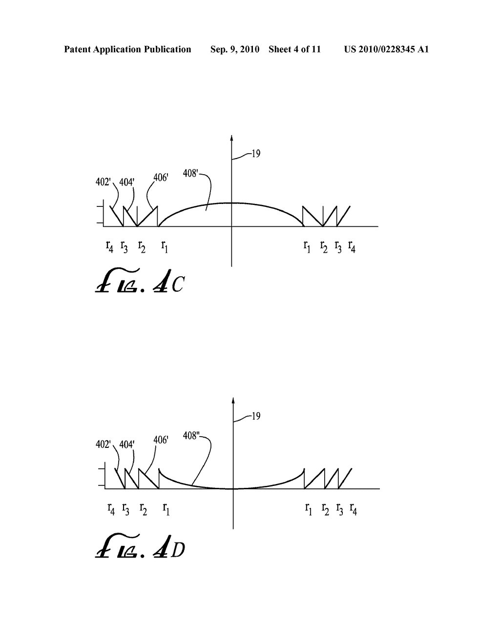 SYSTEM FOR FORMING AND MODIFYING LENSES AND LENSES FORMED THEREBY - diagram, schematic, and image 05