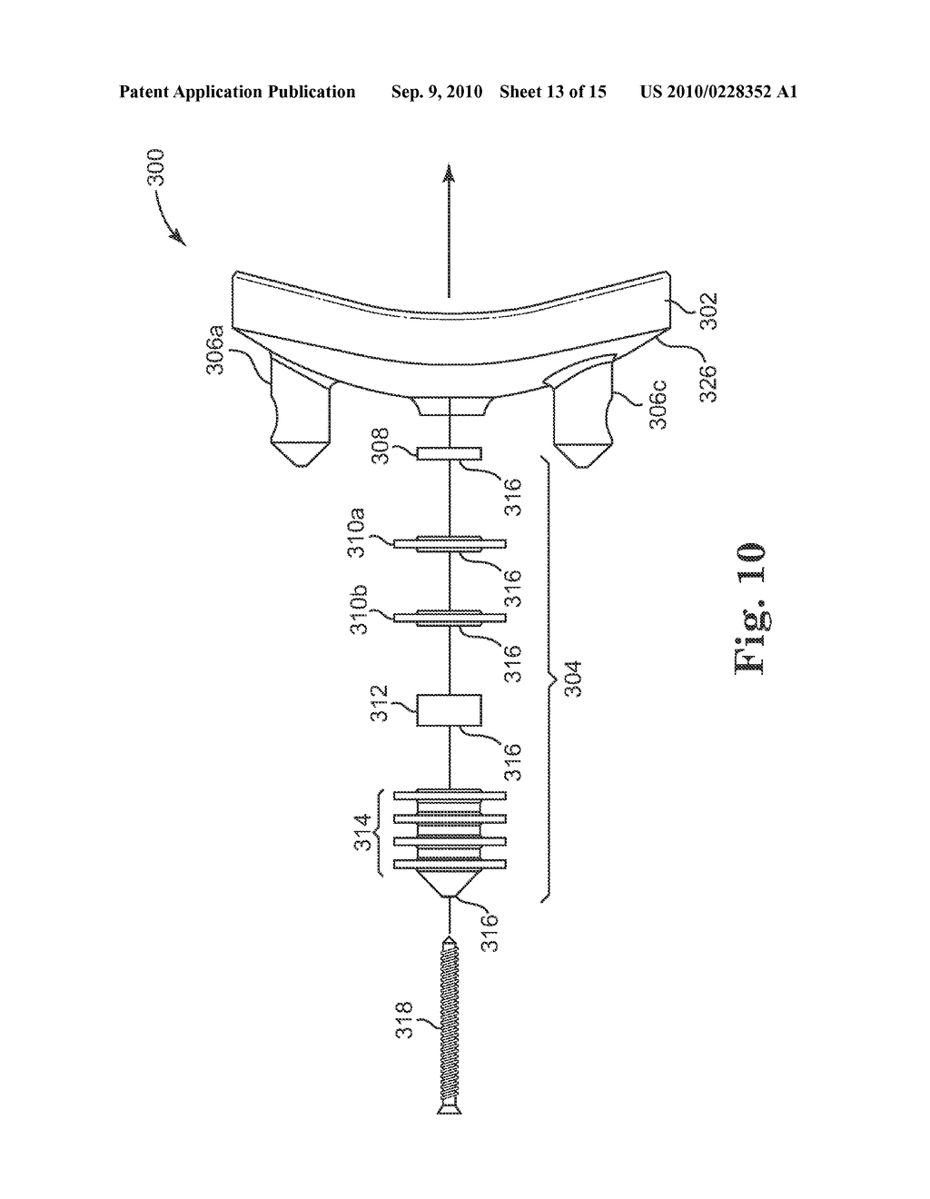 GLENOID IMPLANT ANCHOR POST - diagram, schematic, and image 14