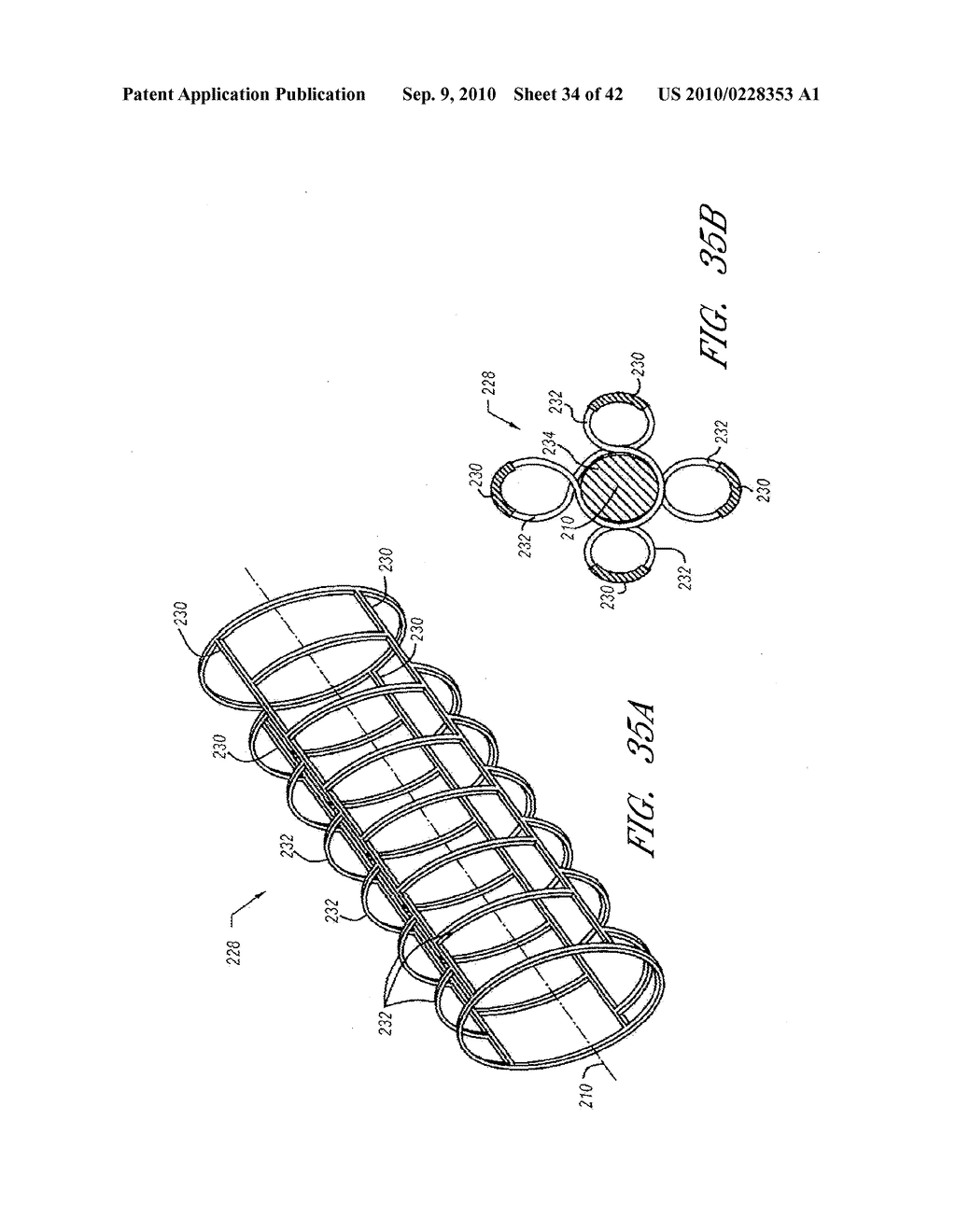 CATHETER DELIVERABLE FOOT IMPLANT AND METHOD OF DELIVERING THE SAME - diagram, schematic, and image 35