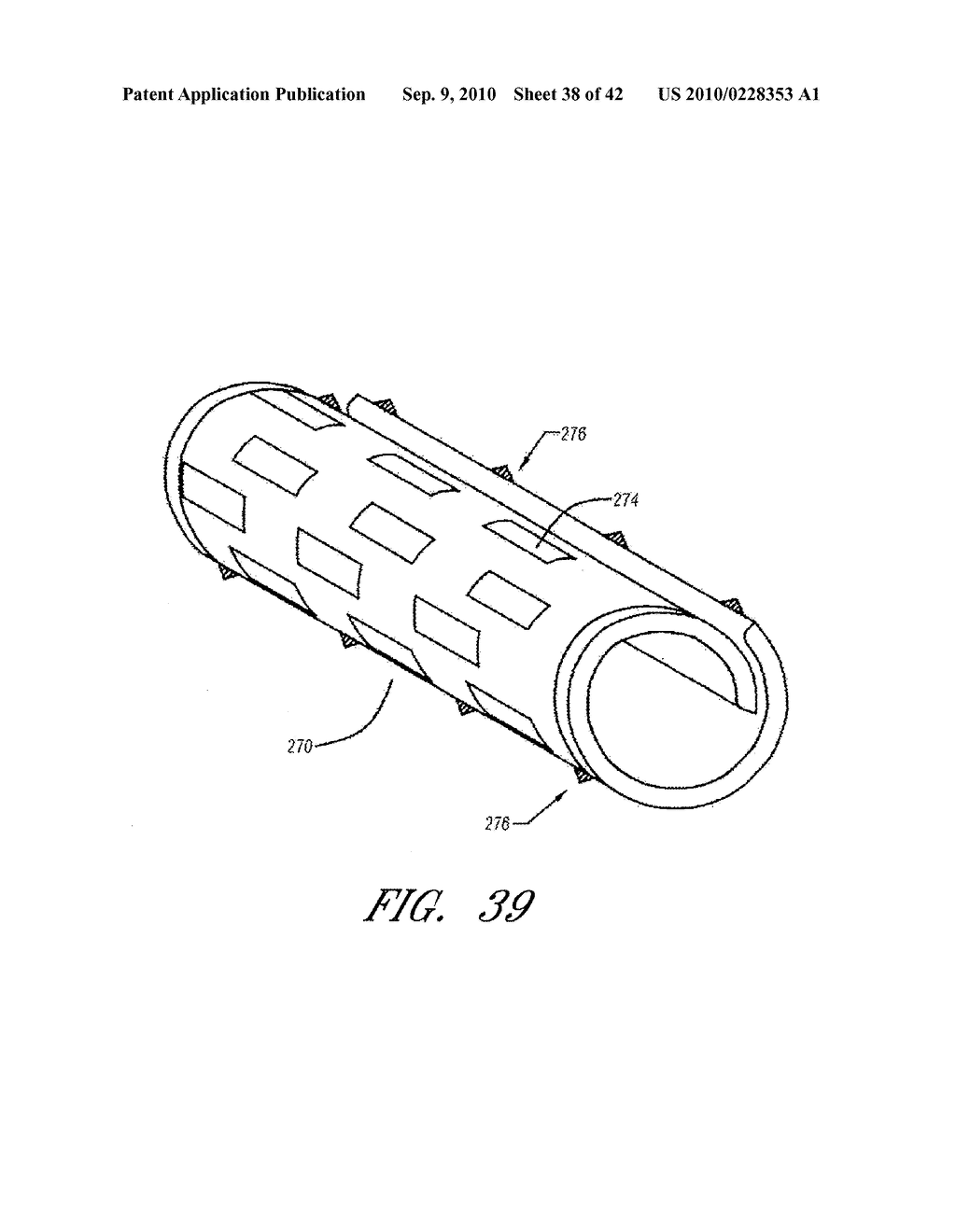 CATHETER DELIVERABLE FOOT IMPLANT AND METHOD OF DELIVERING THE SAME - diagram, schematic, and image 39