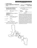 HIP SOCKET WITH ASSEMBLEABLE MALE BALL SHAPE HAVING INTEGRALLY FORMED LIGAMENT AND FEMALE RECEIVER AND INSTALLATION KIT diagram and image