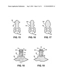 HIP SOCKET WITH ASSEMBLEABLE MALE BALL SHAPE HAVING INTEGRALLY FORMED LIGAMENT AND FEMALE RECEIVER AND INSTALLATION KIT diagram and image