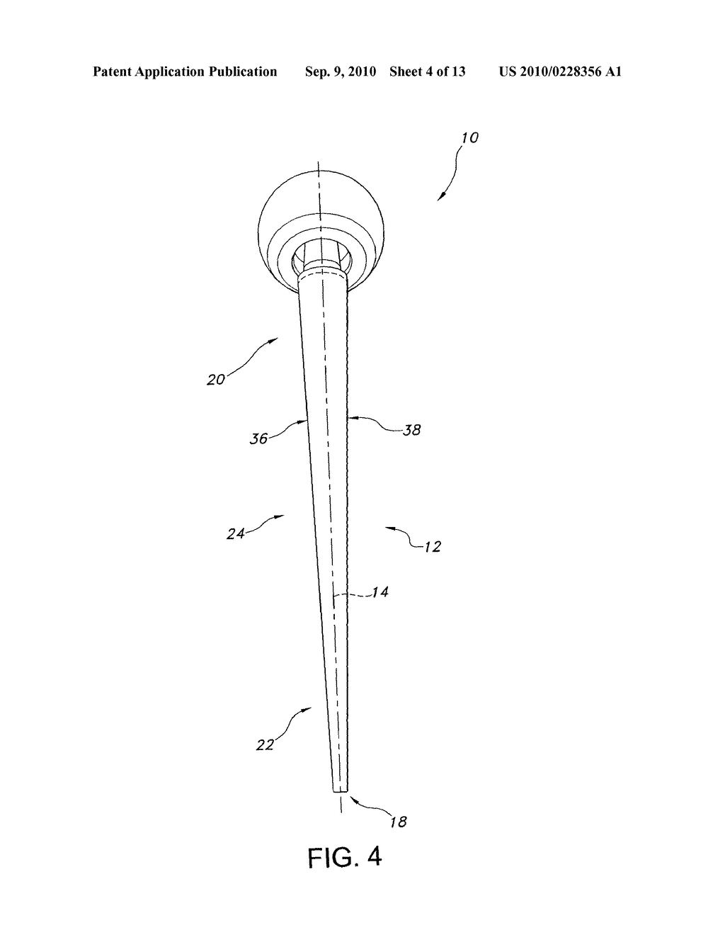 ORTHOPAEDIC IMPLANTS AND METHODS FOR MAKING THE SAME - diagram, schematic, and image 05