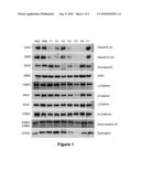 Methods and Compositions for Detecting and Treating End-Stage Cardiomyopathy Using Claudin-5 diagram and image