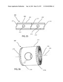 INTERNAL COMBUSTION ENGINES WITH SURCHARGING AND SUPRAIGNITION SYSTEMS diagram and image