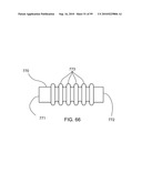 INTERNAL COMBUSTION ENGINES WITH SURCHARGING AND SUPRAIGNITION SYSTEMS diagram and image