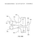 INTERNAL COMBUSTION ENGINES WITH SURCHARGING AND SUPRAIGNITION SYSTEMS diagram and image