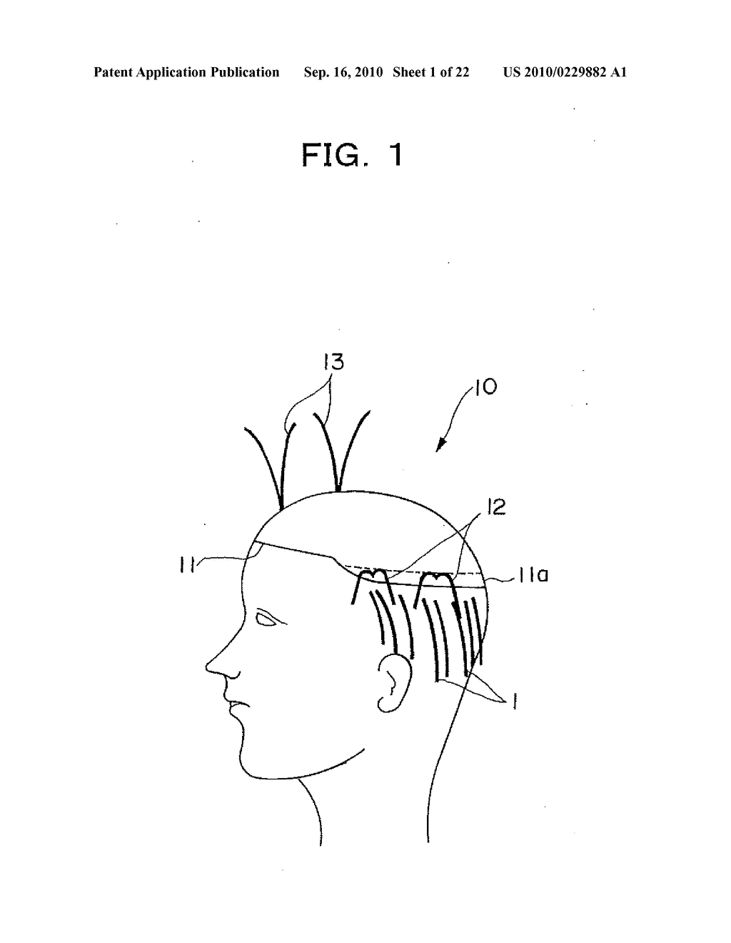 WIG - diagram, schematic, and image 02