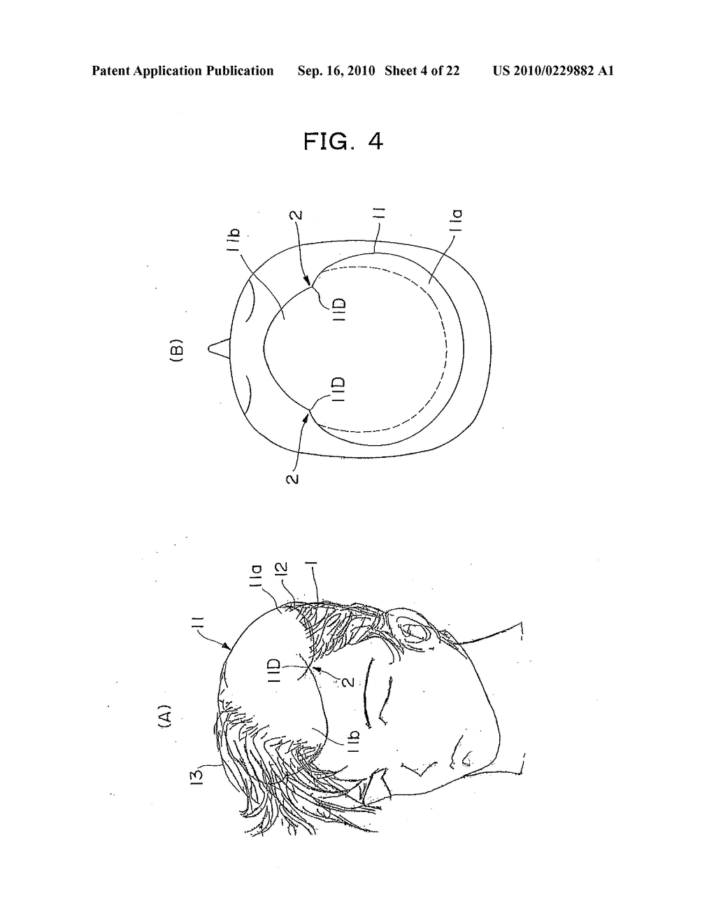 WIG - diagram, schematic, and image 05