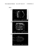 Joint Structure Between a Wound Coil and An IC-Chip for a Noncontact RFID Device and Methods of Manufacturing The Same diagram and image