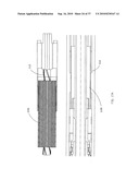 TENSION/COLLAR/REAMER ASSEMBLIES AND METHODS diagram and image