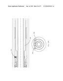 TENSION/COLLAR/REAMER ASSEMBLIES AND METHODS diagram and image