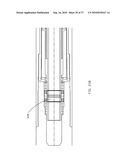 TENSION/COLLAR/REAMER ASSEMBLIES AND METHODS diagram and image