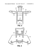 Portable support method and apparatus diagram and image