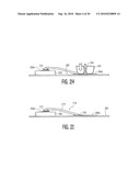 WIRE LOOP AND METHOD OF FORMING THE WIRE LOOP diagram and image