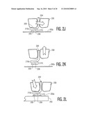 WIRE LOOP AND METHOD OF FORMING THE WIRE LOOP diagram and image