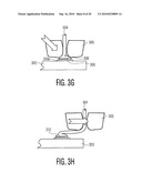 WIRE LOOP AND METHOD OF FORMING THE WIRE LOOP diagram and image