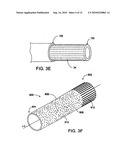 MEDICAL DEVICES diagram and image