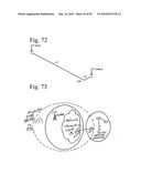 Personal Security System diagram and image