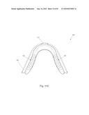 SAFETY EYEWEAR diagram and image