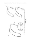 On-Site, Custom Fitted Hearing Equalizer diagram and image