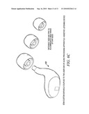 On-Site, Custom Fitted Hearing Equalizer diagram and image