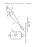 On-Site, Custom Fitted Hearing Equalizer diagram and image