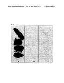 COMPOUNDS FOR USE IN IMAGING, DIAGNOSING AND/OR TREATMENT OF DISEASES OF THE CENTRAL NERVOUS SYSTEM OR OF TUMORS diagram and image