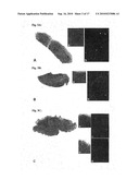 COMPOUNDS FOR USE IN IMAGING, DIAGNOSING AND/OR TREATMENT OF DISEASES OF THE CENTRAL NERVOUS SYSTEM OR OF TUMORS diagram and image