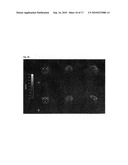 COMPOUNDS FOR USE IN IMAGING, DIAGNOSING AND/OR TREATMENT OF DISEASES OF THE CENTRAL NERVOUS SYSTEM OR OF TUMORS diagram and image