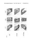 Use of Adipose-Tissue Cell Fractions for Post-Irradiation Tissue Regeneration diagram and image