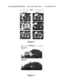 Treating Central Nervous System Injury with Beta and Gamma Secretase Inhibitors diagram and image