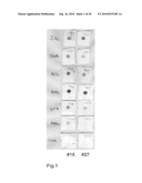 Caries Risk Test for Predicting and Assessing the Risk of Disease diagram and image