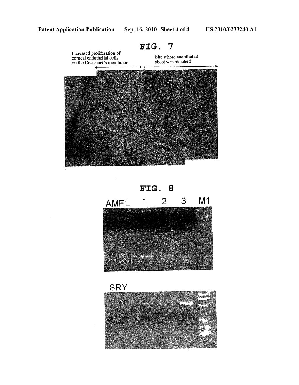 CORNEAL ENDOTHELIAL PREPARATION WHICH ENABLES CELLS TO GROW IN VIVO - diagram, schematic, and image 05