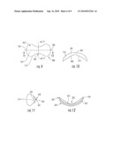 OPHTHALMIC DRUG DELIVERY SYSTEM AND APPLICATIONS diagram and image