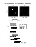 Vaccine Nanotechnology diagram and image