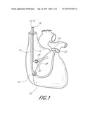 DEVICE AND METHODS FOR DELIVERY OF BIOACTIVE MATERIALS TO THE RIGHT SIDE OF THE HEART diagram and image