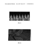 COLORED WEB MATERIAL COMPRISING A PLURALITY OF DISCRETE EXTENDED ELEMENTS diagram and image