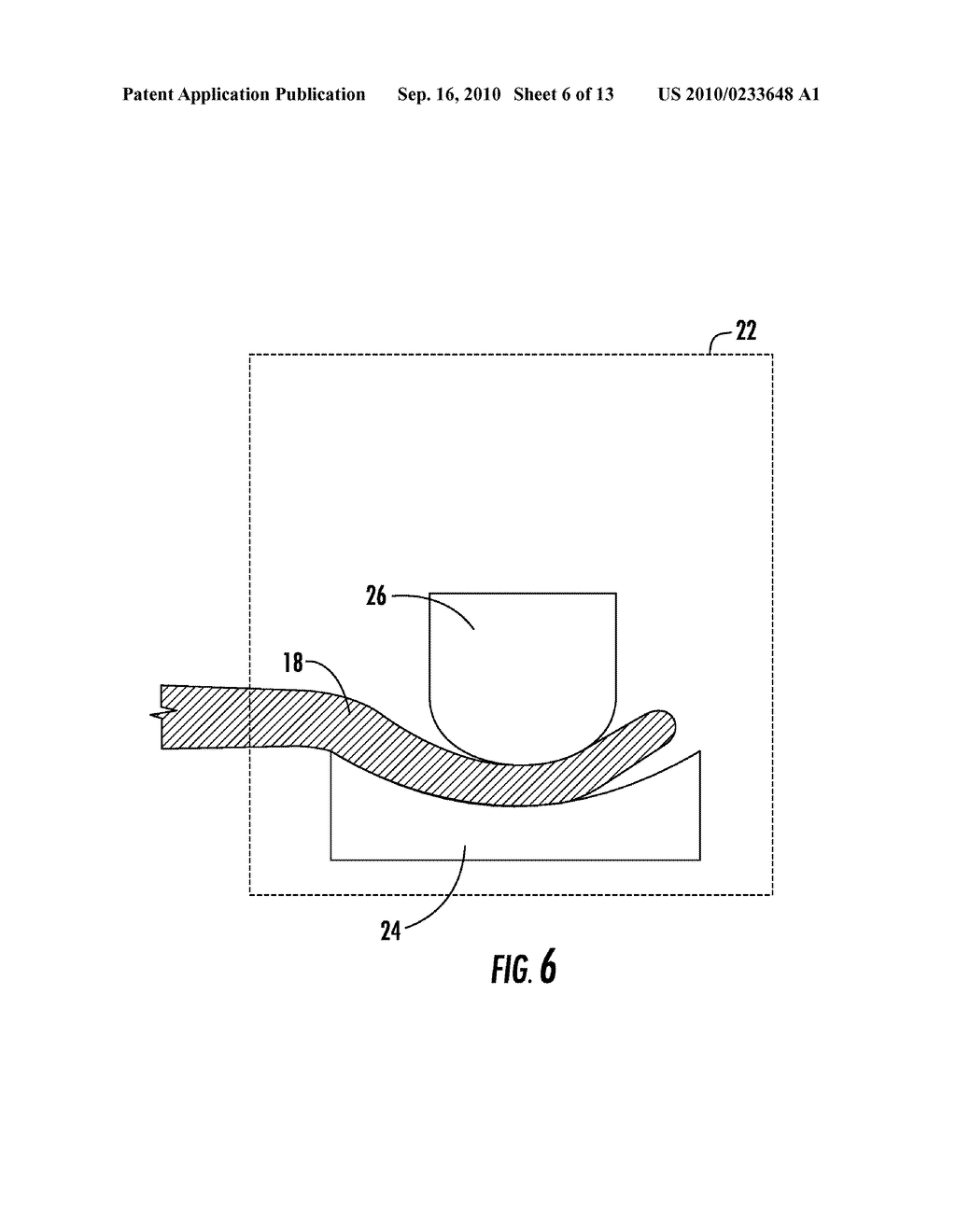 ENDODONTIC INSTRUMENT AND METHOD OF MANUFACTURING - diagram, schematic, and image 07