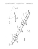 GOLF AIDS diagram and image