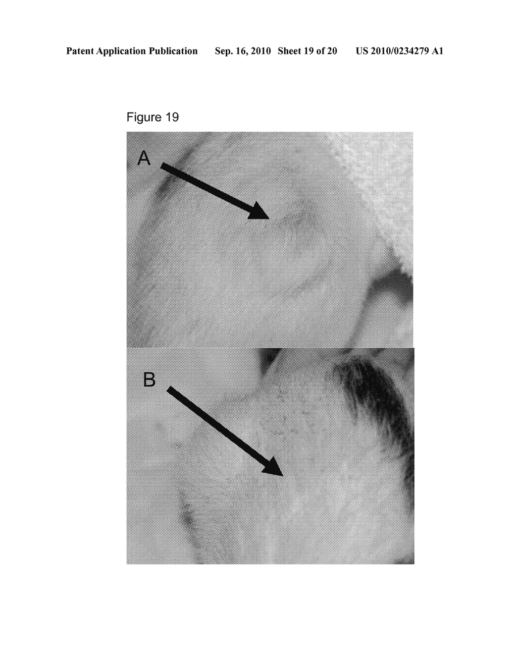 Soluble Hydrophobic Core Carrier Compositions for Delivery of Therapeutic Agents, Methods of Making and Using the Same - diagram, schematic, and image 20