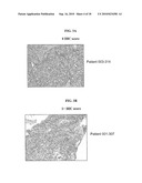 BIOMARKERS AND METHODS FOR DETERMINING SENSITIVITY TO VASCULAR ENDOTHELIAL GROWTH FACTOR RECEPTOR-2 MODULATORS diagram and image