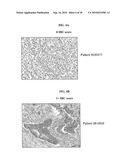 BIOMARKERS AND METHODS FOR DETERMINING SENSITIVITY TO VASCULAR ENDOTHELIAL GROWTH FACTOR RECEPTOR-2 MODULATORS diagram and image