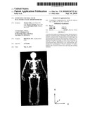 Estimating Visceral Fat By Dual-Energy X-Ray Absorptiometry diagram and image