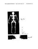 Estimating Visceral Fat By Dual-Energy X-Ray Absorptiometry diagram and image