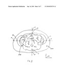 Estimating Visceral Fat By Dual-Energy X-Ray Absorptiometry diagram and image