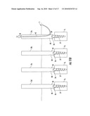 Method And Apparatus For Facilitating Navigation Of An Implant diagram and image