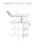 Method And Apparatus For Facilitating Navigation Of An Implant diagram and image